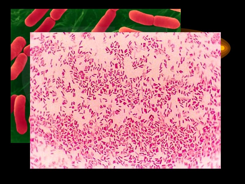 大肠埃希氏菌.gif